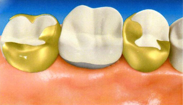 ヒューマンブリッジ
